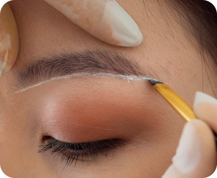 Eyebrow Transplant