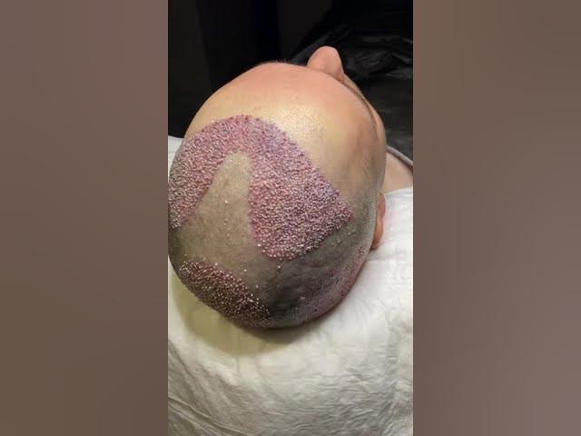 https://www.youtube.com/watch?v=H96L3ln8Pbo&embeds_referring_euri=https%3A%2F%2Fwww.estezehair.com%2F&source_ve_path=MjM4NTE
